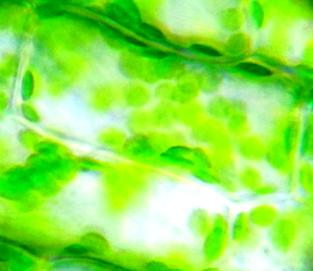 "Elodea chloroplasts at 400X" by "albertstraub" (CC BY 2.0)